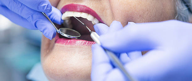 Best Emergency Gum Treatment in Myrtle Grove, FL